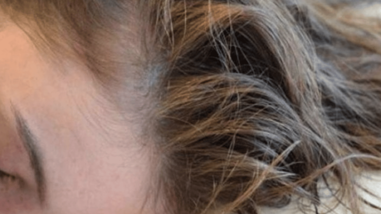 Foto - Sinüsten tutun da anatomik hastalıklara kadar... Islak saçla uyumanın tehlikeleri