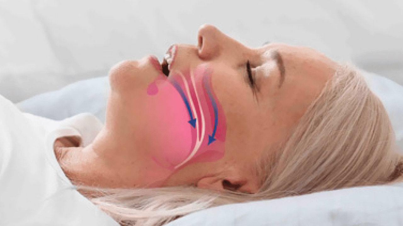 Sıradan bir gürültü değil... Horlama deyip geçmeyin! Hayati bir alarm zili olabilir