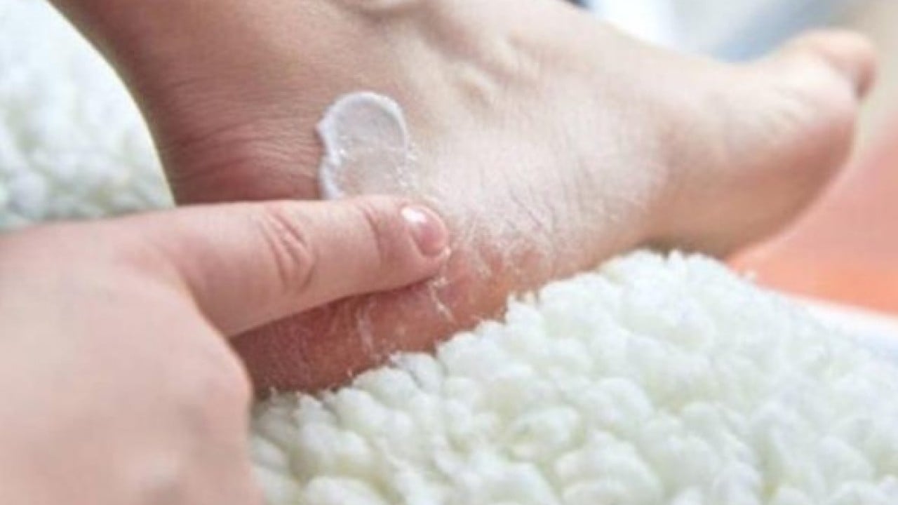 Foto - Sırrı ortaya çıktı! Nasır tutmuş topukları pamuk gibi yapıyor