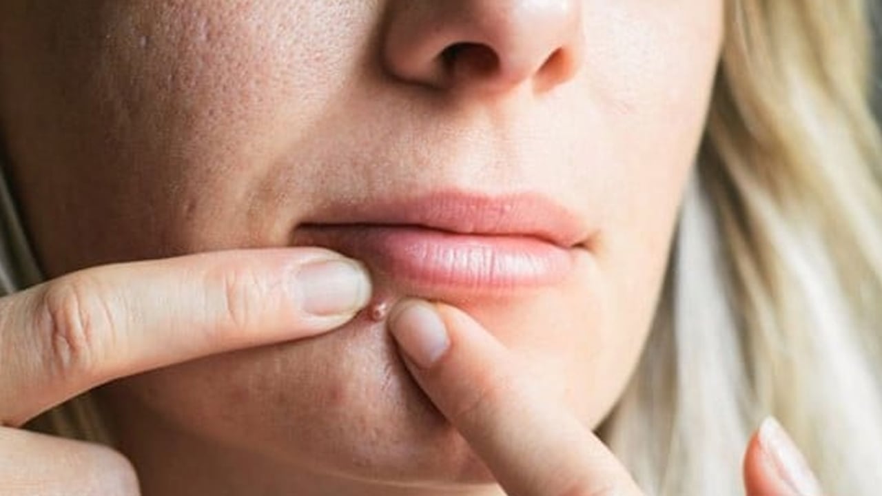 Foto - Sivilcenin kökünü kazıyor: Maya maskesi pullanıp dökülmeye mani oluyor! Hoşluk maskesi herkesin yeni favorisi