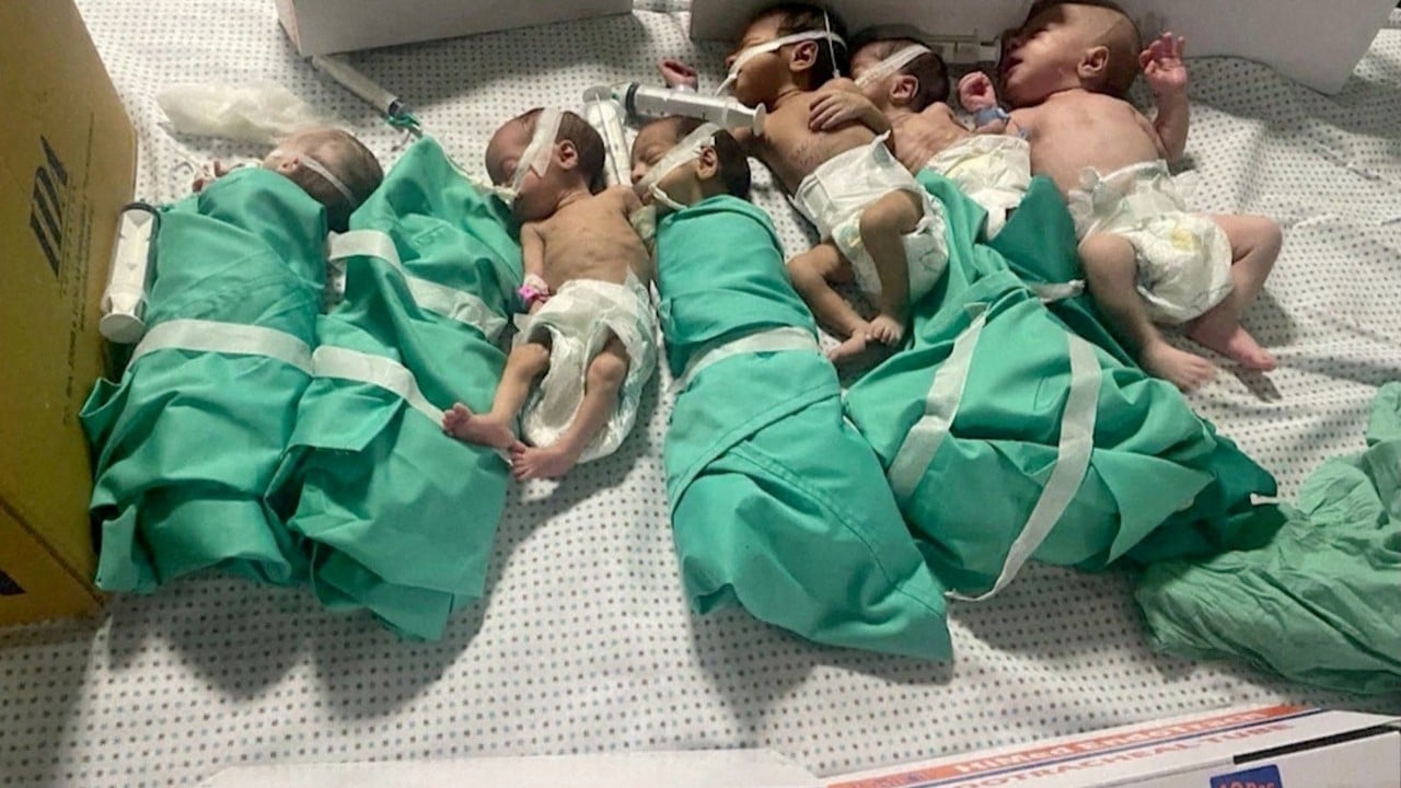 Foto - Siyonistten 1001 gece zulümleri Artık bombadan çok hastalık öldürüyor