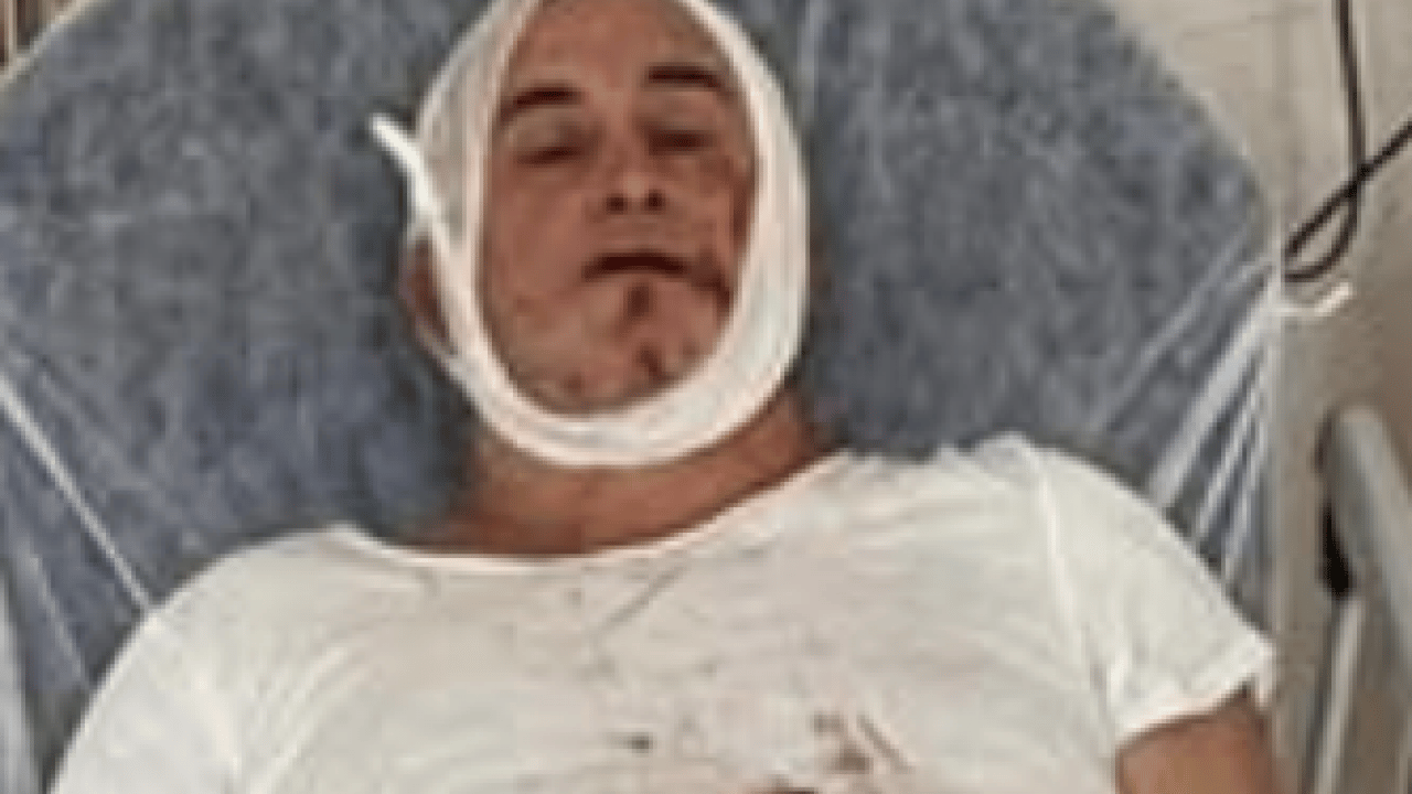 Skandala bakın... Kaş’ta maç sonrası şiddet olayı: Çenesi kırılan velinin tedavisi sürüyor