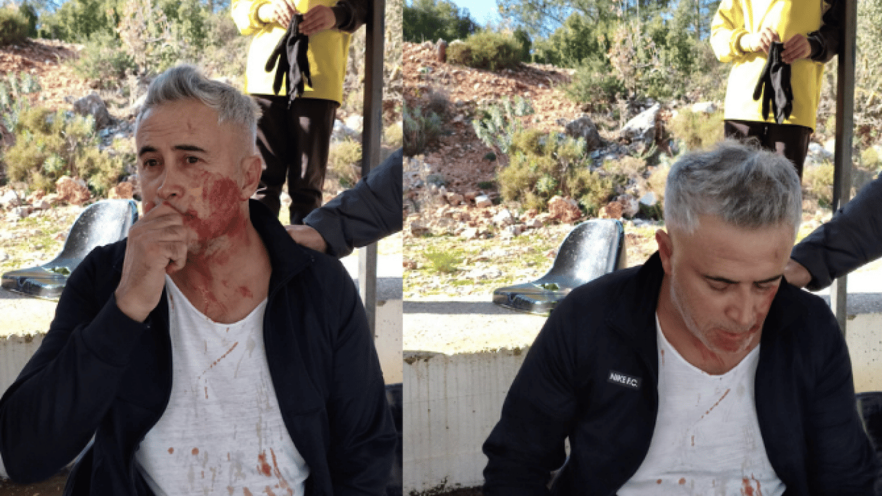Foto - Skandala bakın... Kaş’ta maç sonrası şiddet olayı: Çenesi kırılan velinin tedavisi sürüyor