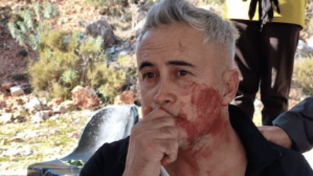 Foto - Skandala bakın... Kaş’ta maç sonrası şiddet olayı: Çenesi kırılan velinin tedavisi sürüyor