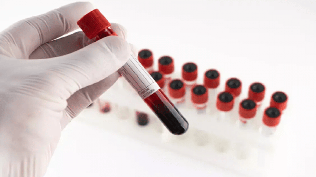 Foto - Bu kan grubuna sahip olanlar dikkat: Kış ayları size göre olmayabilir!