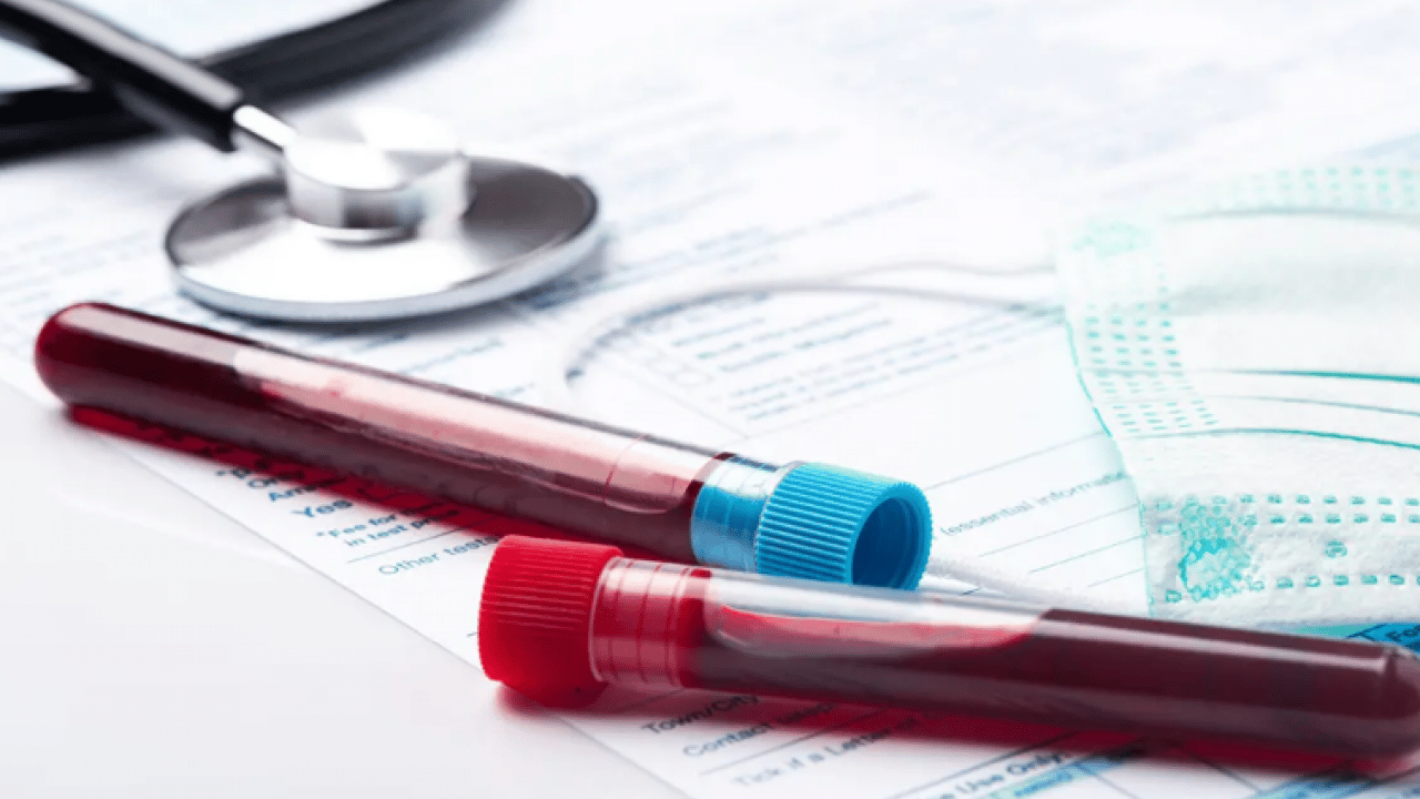 Foto - Bu kan grubuna sahip olanlar dikkat: Kış ayları size göre olmayabilir!