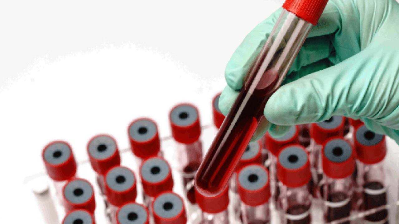 Foto - Bu kan grubuna sahip olanlar dikkat: Kış ayları size göre olmayabilir!