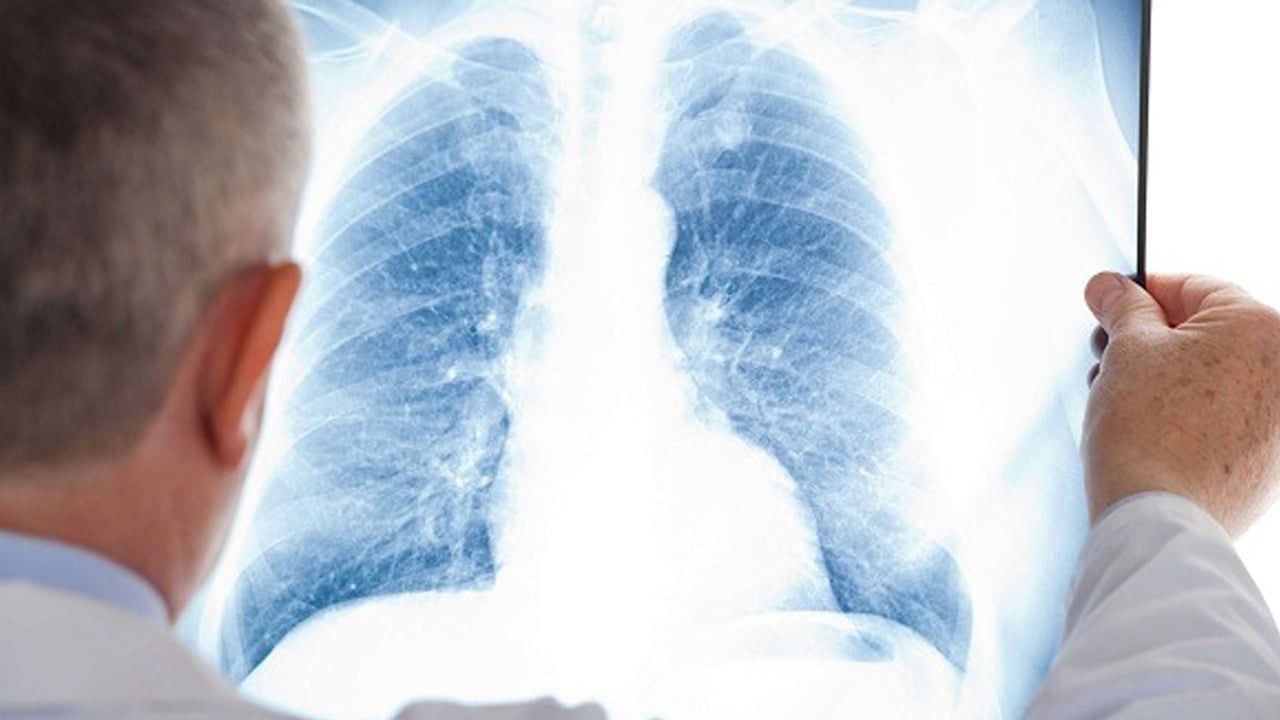 Foto - Soğuk havaya karşı kalkan görevi gören bu vitamin akciğerleri koruyabilir! Bilim insanları açıkladı, duyan şok yaşıyor