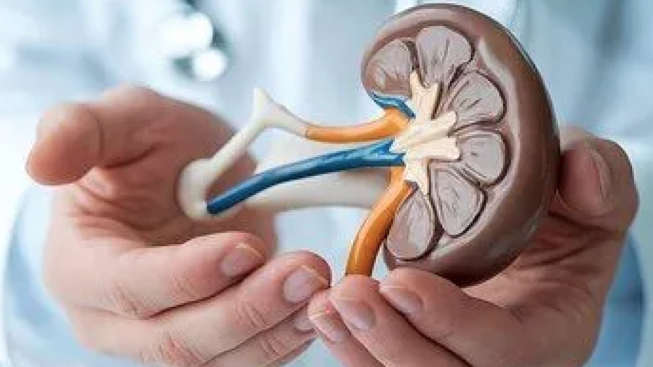 Foto - Şok eden 'taş' detayı! Duyan mutlaka bu önlemi almalı: Böbrek hastalıklarında taş ağrısı...
