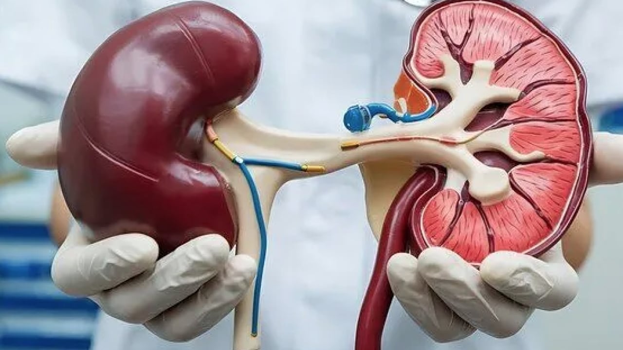 Şok eden 'taş' detayı! Duyan mutlaka bu önlemi almalı: Böbrek hastalıklarında taş ağrısı...