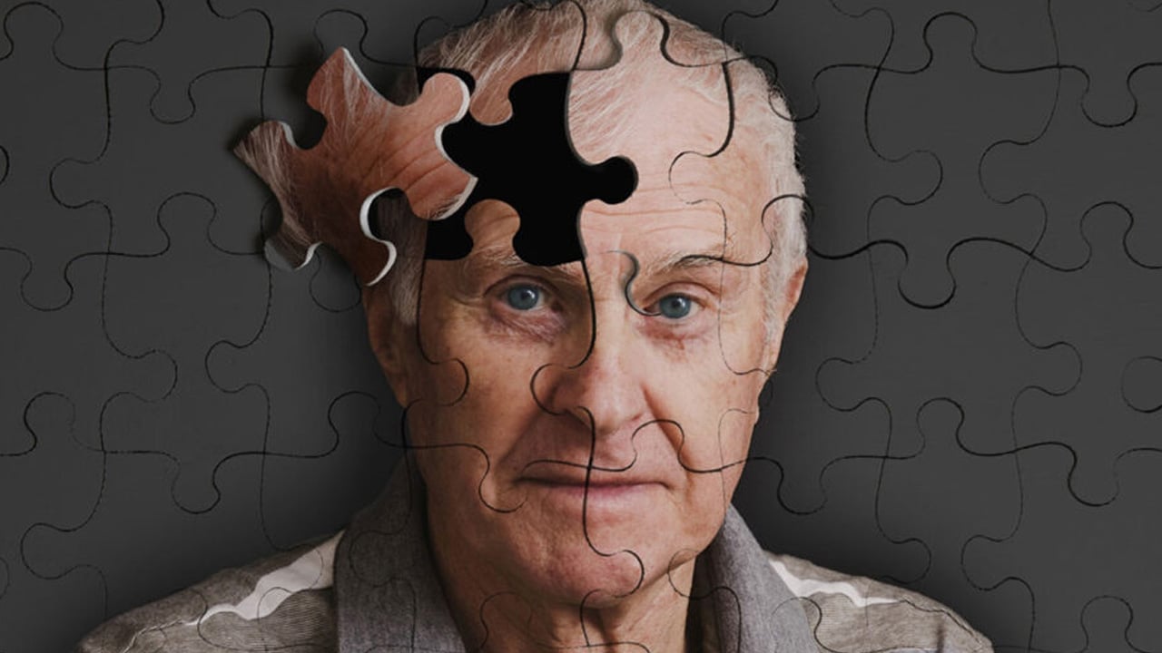 Foto - Şok edici detay: Alzheimer'ın gizli sinyali meğer parmaklarınızın ucundaymış! O sırrı biliyor muydunuz?