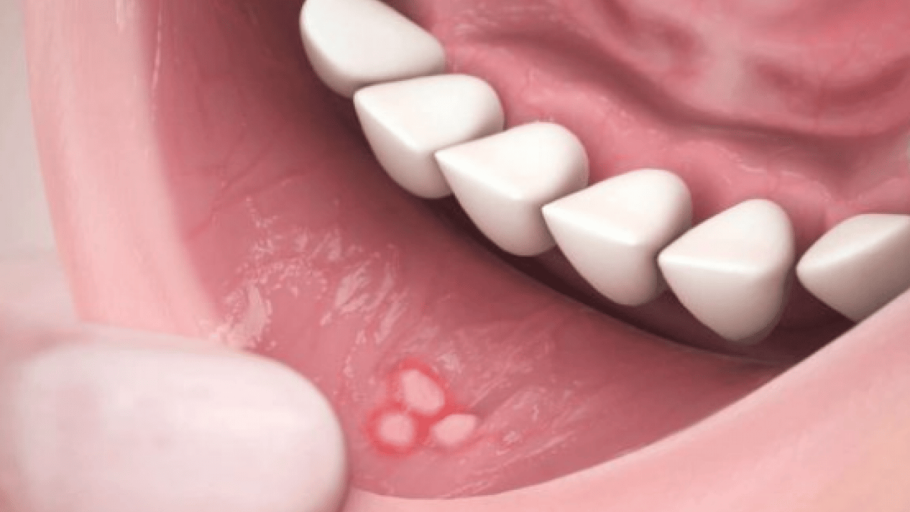 Şok gerçek! Ağızdaki düşman ortaya çıktı: Kalp ve beyin sağlığını tehdit ediyor! Hemen önlem almalıyız bekleyen kaybeder