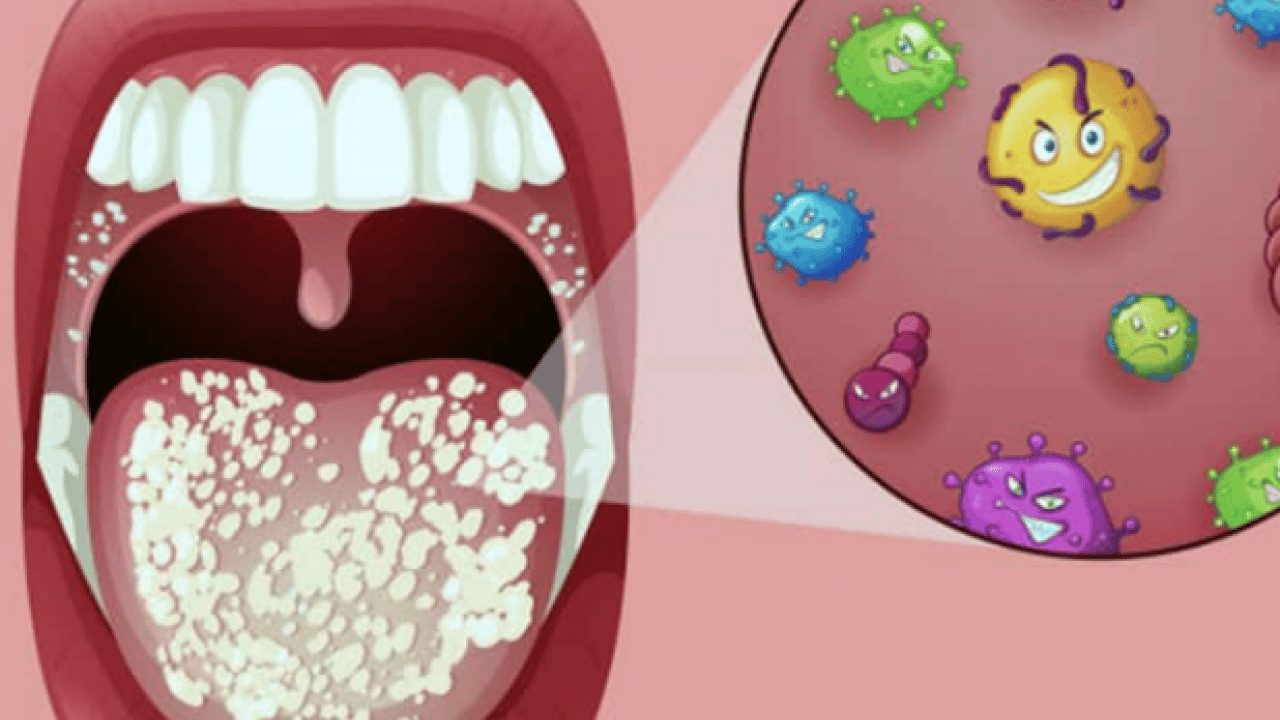 Foto - Şok gerçek! Ağızdaki düşman ortaya çıktı: Kalp ve beyin sağlığını tehdit ediyor! Hemen önlem almalıyız bekleyen kaybeder