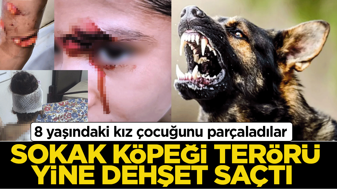 Sokak köpeği terörü yine dehşet saçtı: 8 yaşındaki kız çocuğunu parçaladılar