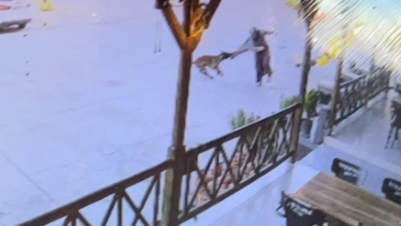 Foto - Sokak terörünün son kurbanı: Gözü dönmüş köpek kadının kolunu kopardı