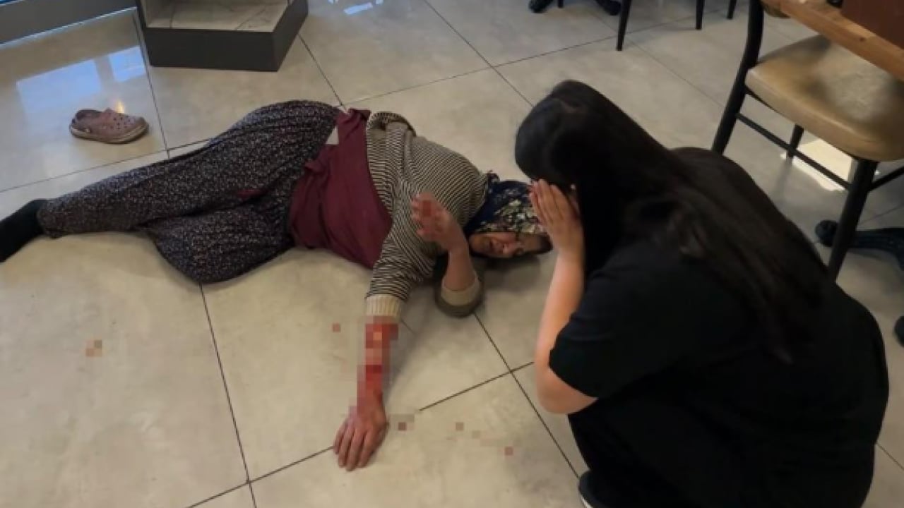 Foto - Sokak terörünün son kurbanı: Gözü dönmüş köpek kadının kolunu kopardı