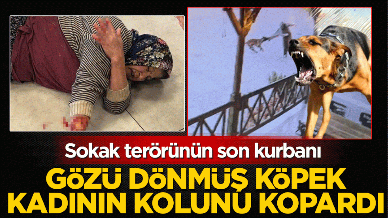 Sokak terörünün son kurbanı: Gözü dönmüş köpek kadının kolunu kopardı