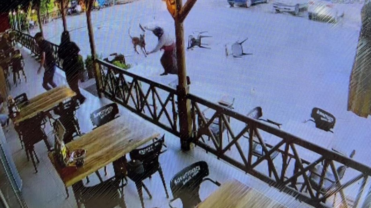 Foto - Sokak terörünün son kurbanı: Gözü dönmüş köpek kadının kolunu kopardı