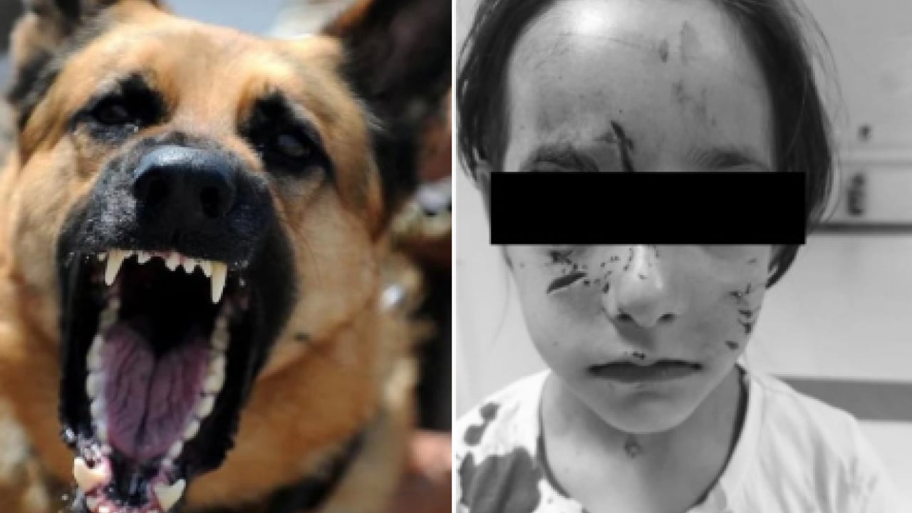 Foto - Sokak terörünün sözcülüğüne soyundu! Köpeksevici Belovacıklı’dan vahşeti görmezden gelen alçaklık! Çocuk ölümleri umrunda değil