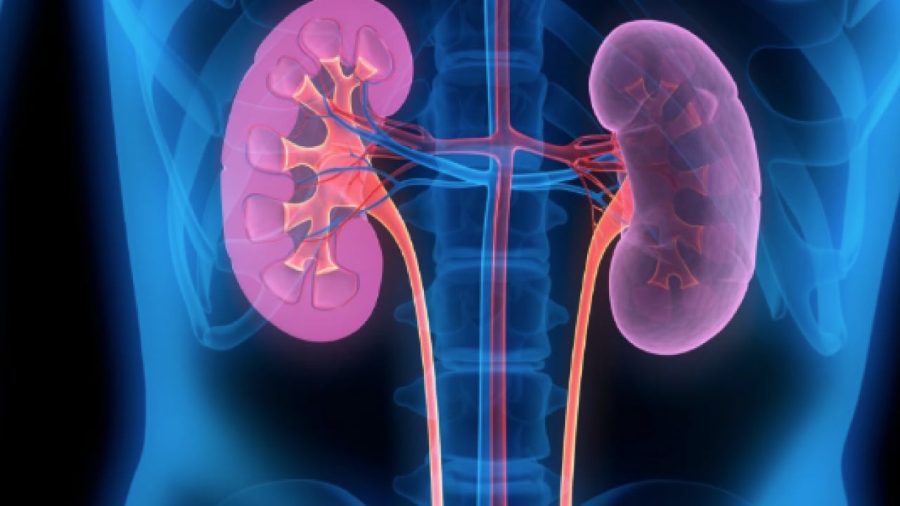 Foto - Son yıllarda büyük problem... Böbrek taşını düşüren sebze! C vitamini yüklü...