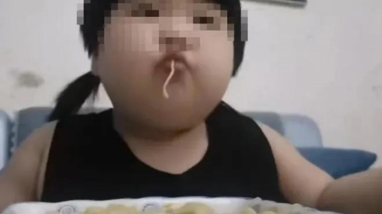 Foto - Sosyal medyanın en iğrenç yüzü: Tık uğruna 3 yaşındaki bebeği obez yaptılar