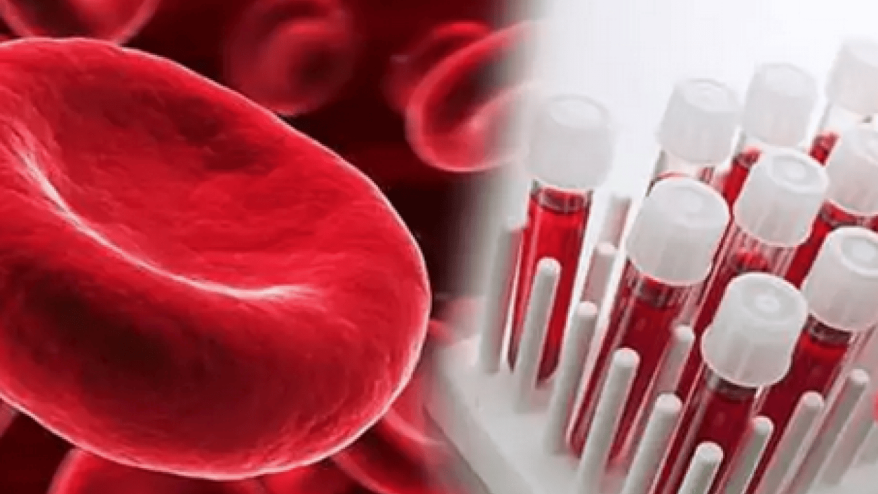 Foto - Sürpriz çıktı: Dünyada tek bir kişide görülen kan grubu tespit edildi!