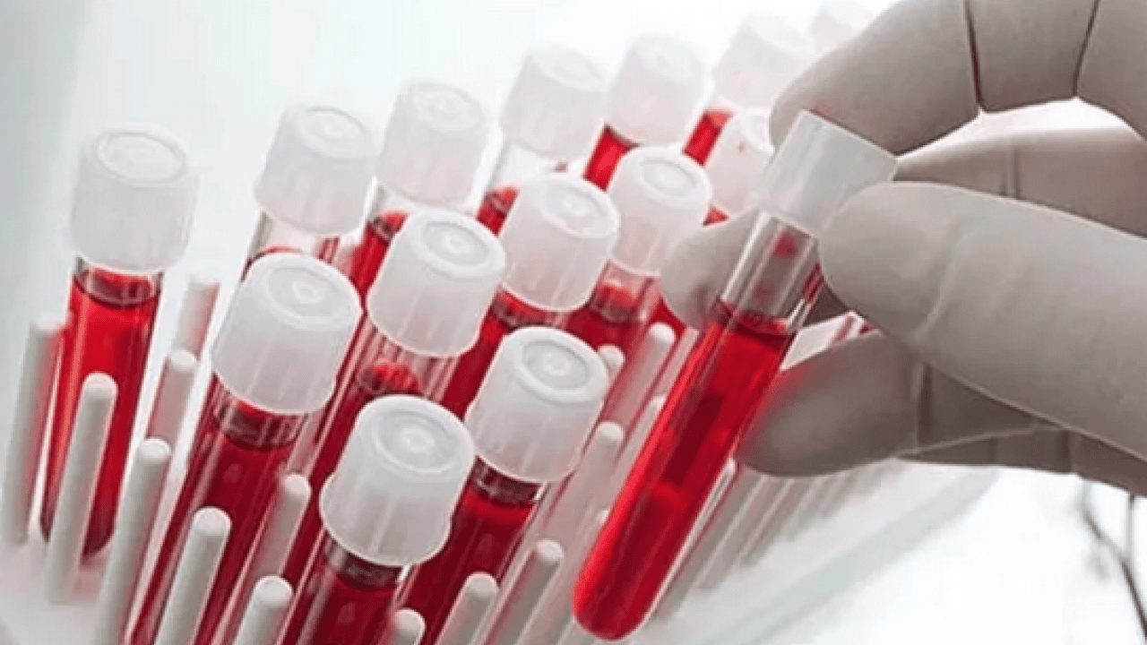 Sürpriz çıktı: Dünyada tek bir kişide görülen kan grubu tespit edildi!