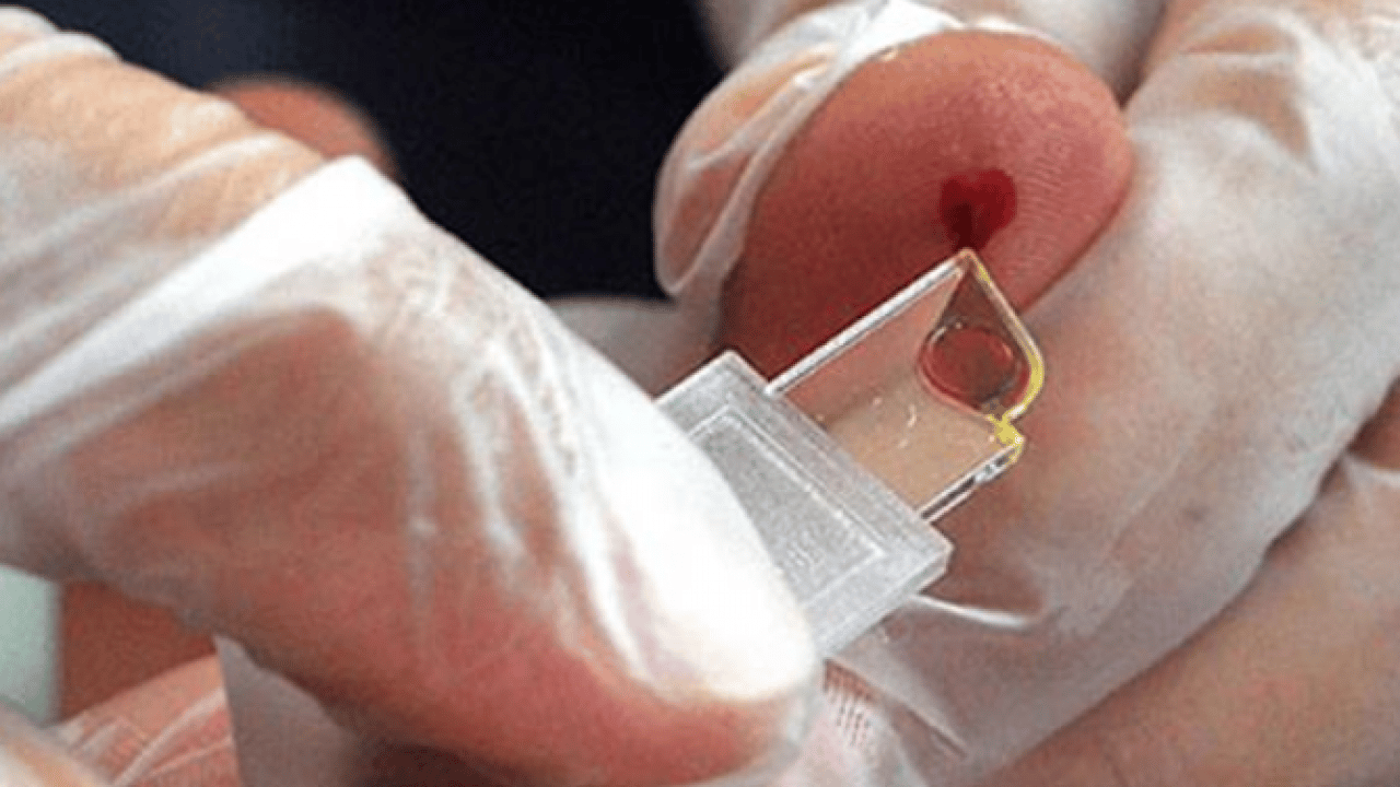 Foto - Sürpriz çıktı: Dünyada tek bir kişide görülen kan grubu tespit edildi!