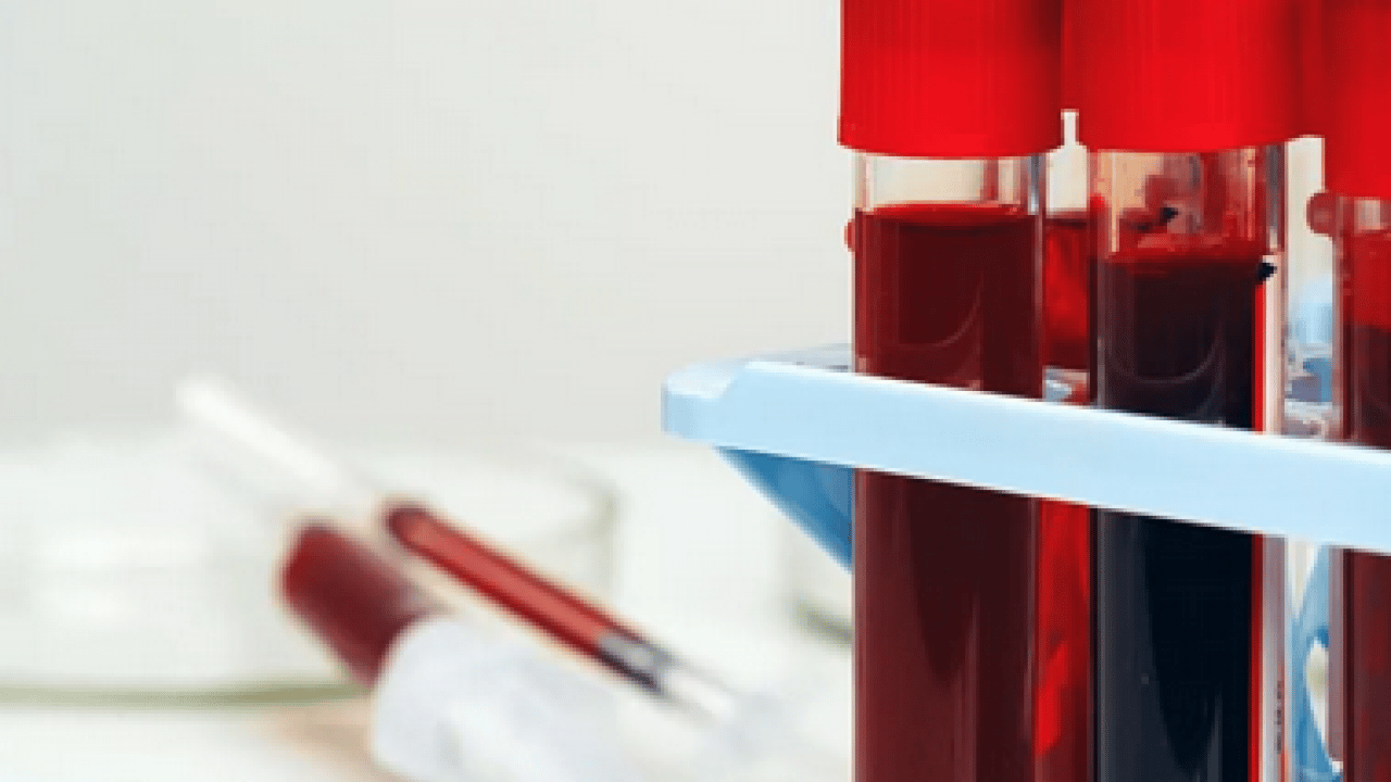 Foto - Sürpriz çıktı: Dünyada tek bir kişide görülen kan grubu tespit edildi!