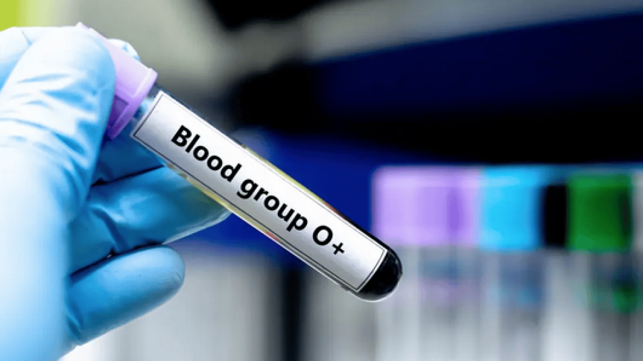Foto - Sürpriz çıktı: Dünyada tek bir kişide görülen kan grubu tespit edildi!