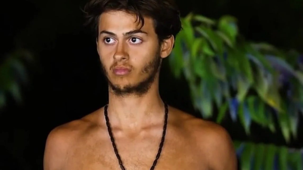Foto - Survivor oyuncusu bacağını kaybetti: Yarışma iptal edildi