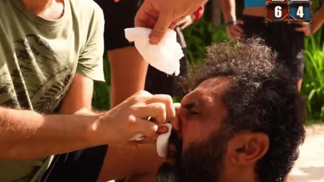Foto - Survivor'da korkutan anlar! Ünlü şarkıcı kanlar içinde kaldı! 