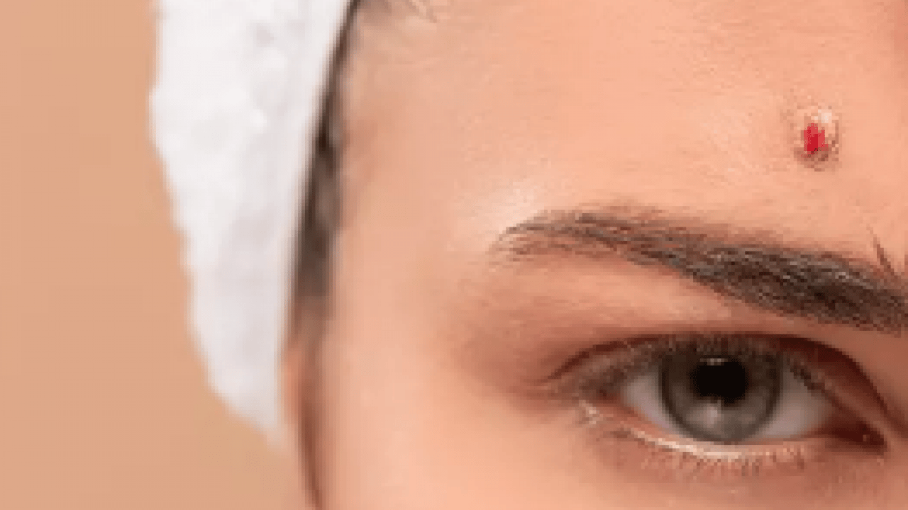 Foto - Tam bir çözüm metodu: Sivilce izlerini tek gecede siliyor! Aktarlarda kapış kapış satılıyor...