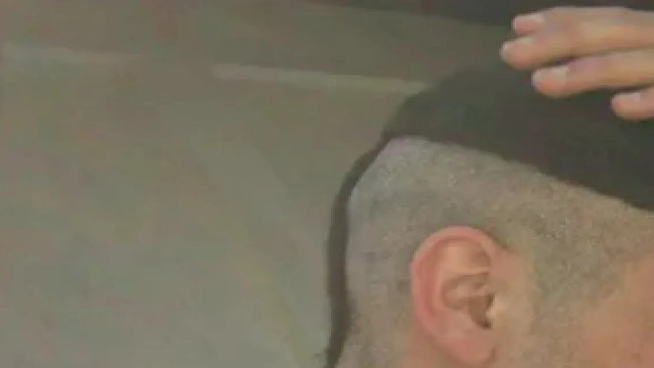 Foto - Tas kafa tıraşı haram mı? İsmail Yaşar Hoca açıkladı