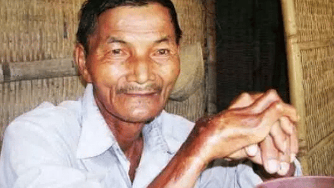 Foto - Tıp dünyası böylesini görmedi: 60 yıldır her yolu denedi olmadı!