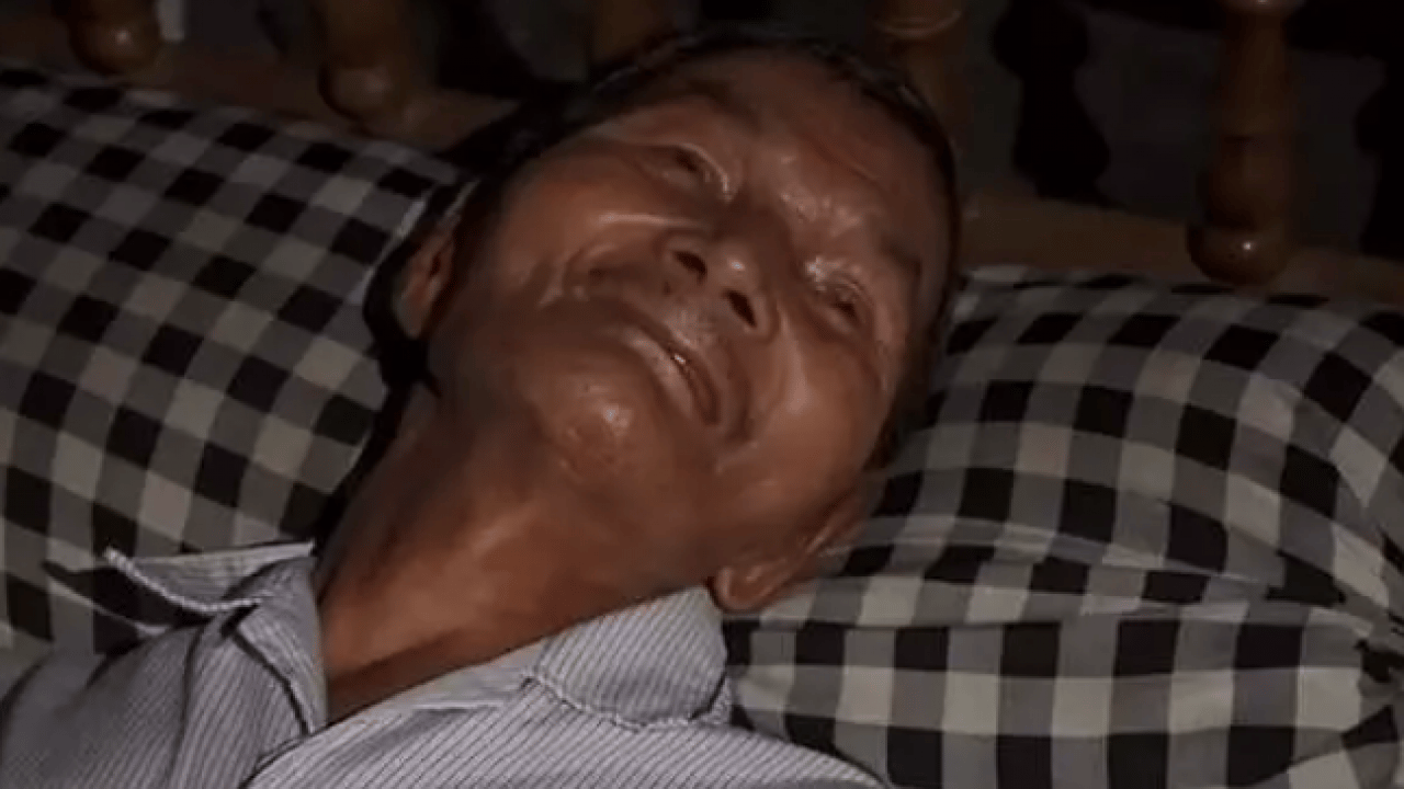 Foto - Tıp dünyası böylesini görmedi: 60 yıldır her yolu denedi olmadı!