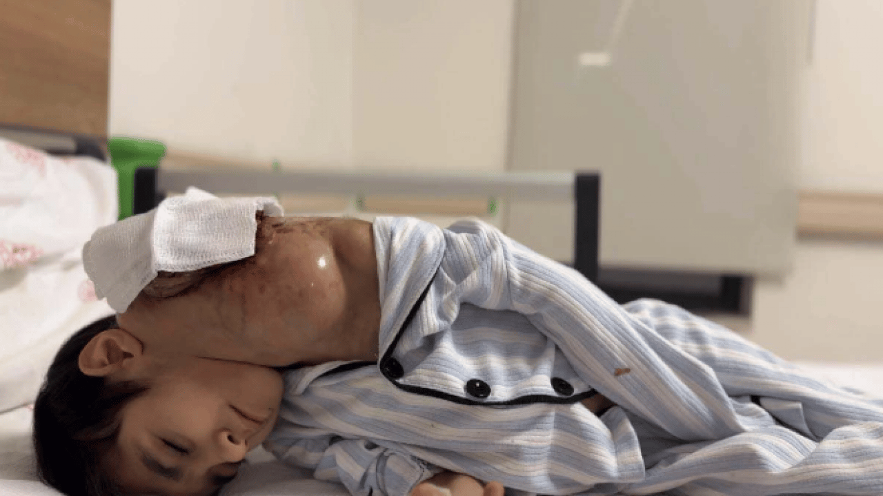 Foto - Tıp tarihine giren mucize! 10 kiloluk çocuktan 3 kiloluk tümor çıktı