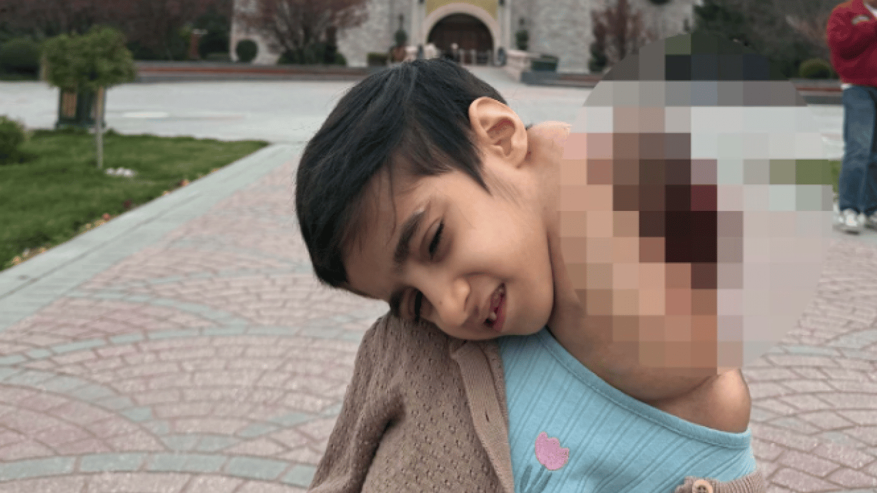 Foto - Tıp tarihine giren mucize! 10 kiloluk çocuktan 3 kiloluk tümor çıktı