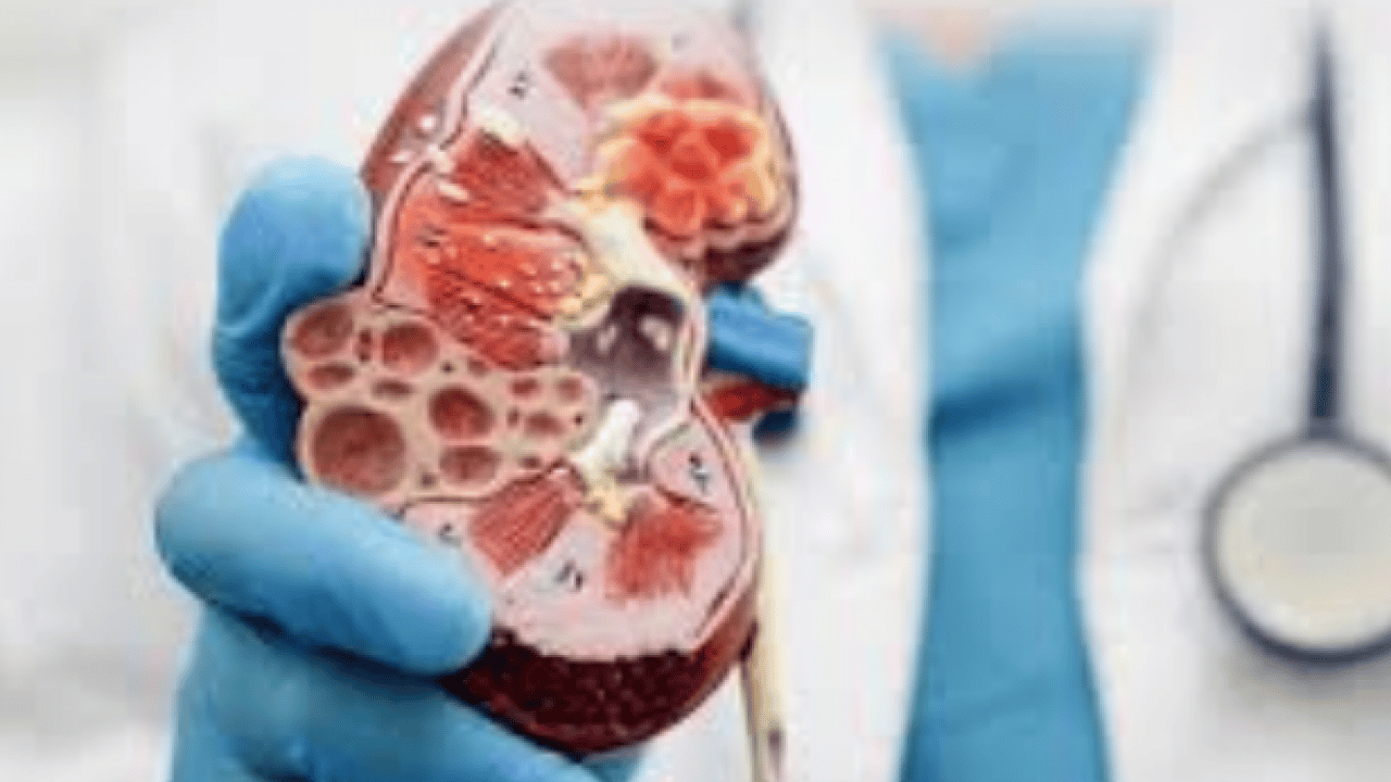 Foto - Tüm hastalıklara pansuman olacak! Böbreklerin süzgeci meyve... Kum ve taş bırakmıyor