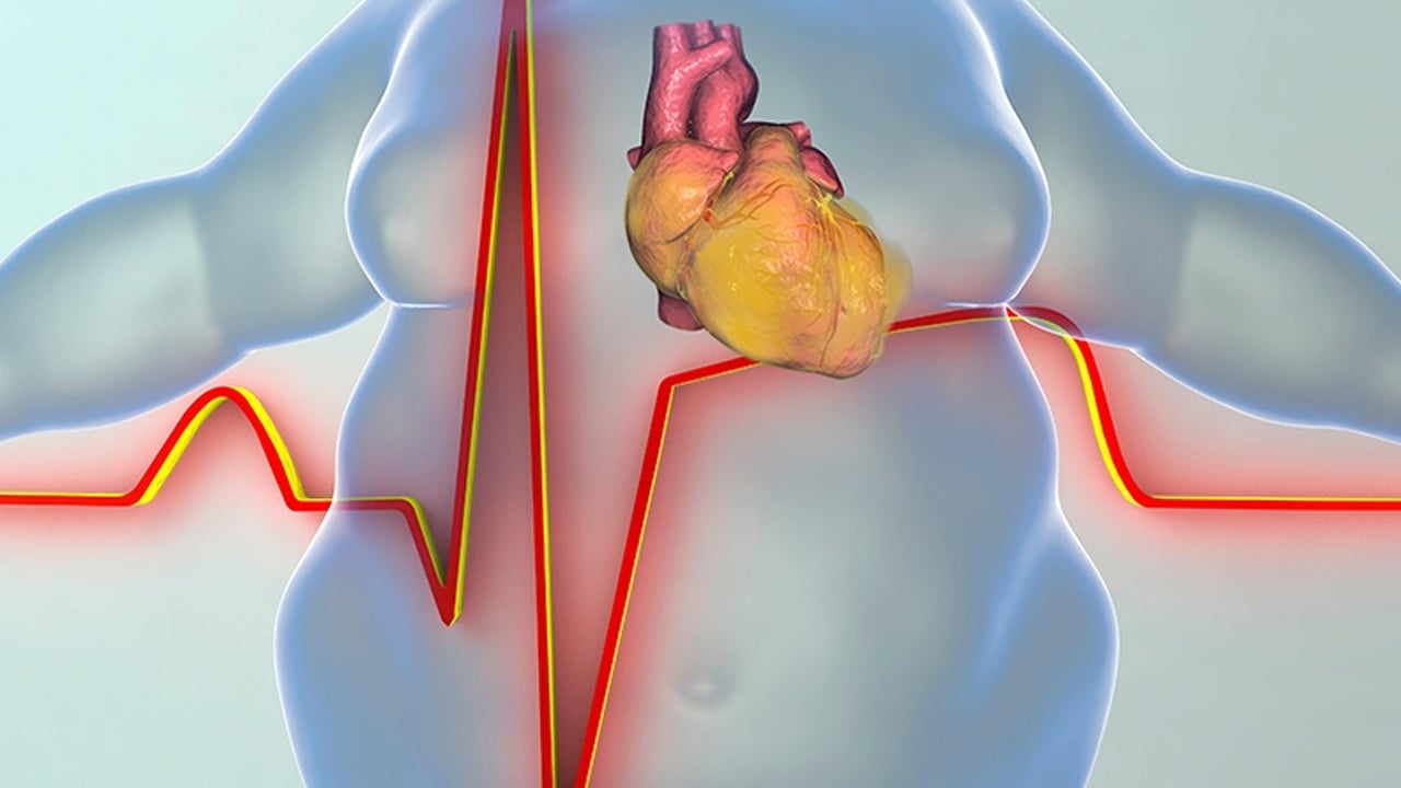 Foto - Tüm organları bitiren besinler: Kalp ve damar sağlığına da büyük darbe vurur! Rafına uğramayın