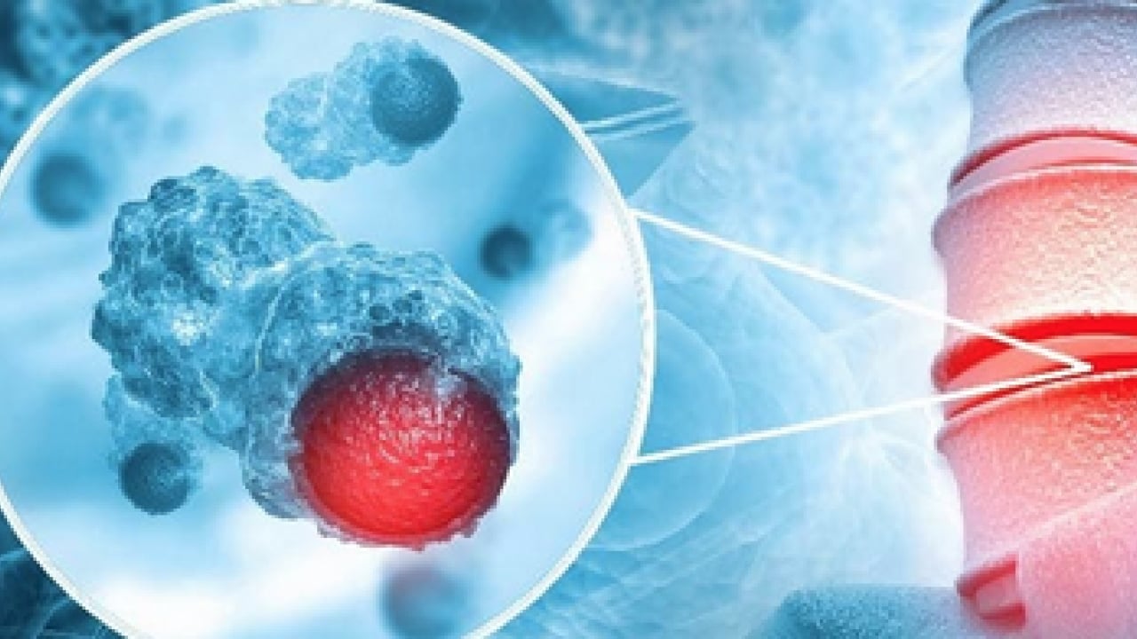 Foto - Tümör belasının önüne geçecek koruyucu cerrahi: Kemik tümörlerinde yeni dönem