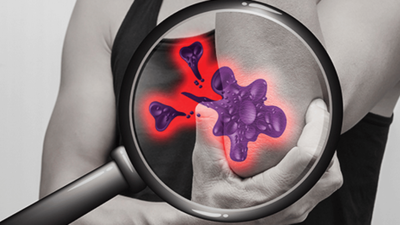 Tümör belasının önüne geçecek koruyucu cerrahi: Kemik tümörlerinde yeni dönem