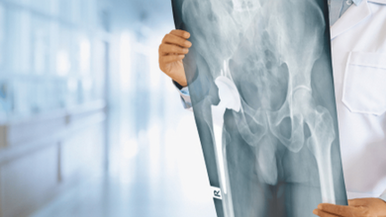 Foto - Tümör belasının önüne geçecek koruyucu cerrahi: Kemik tümörlerinde yeni dönem