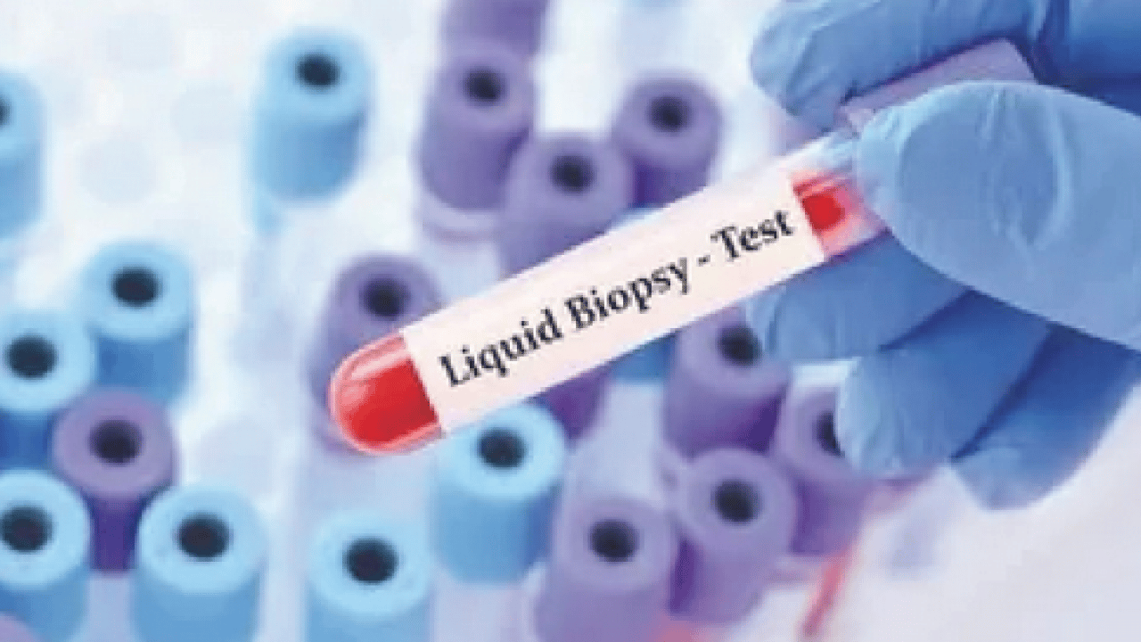 Foto - Tümöre ait DNA parçaları... Likit biyopsi kanser takibinde tedavi sürecinin izlenmesine katkı sağlıyor