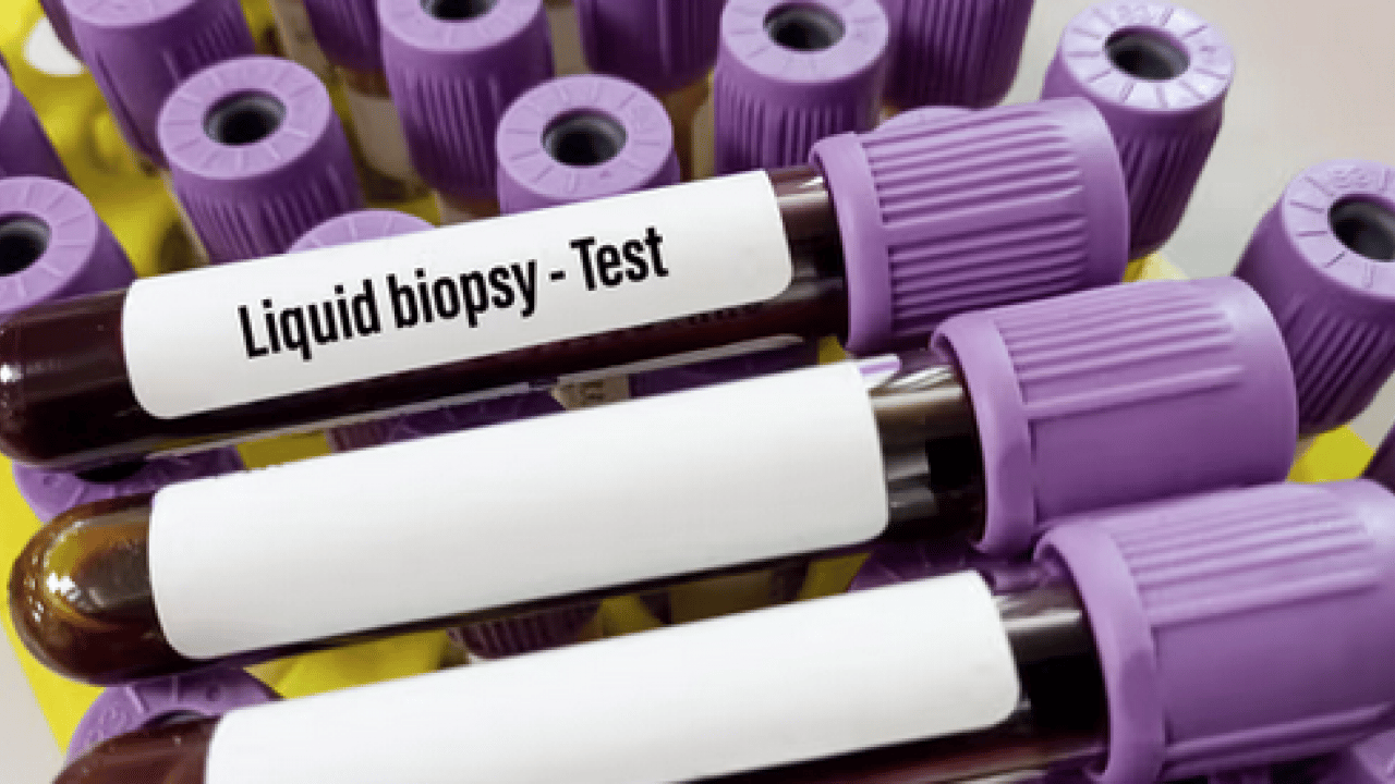 Foto - Tümöre ait DNA parçaları... Likit biyopsi kanser takibinde tedavi sürecinin izlenmesine katkı sağlıyor