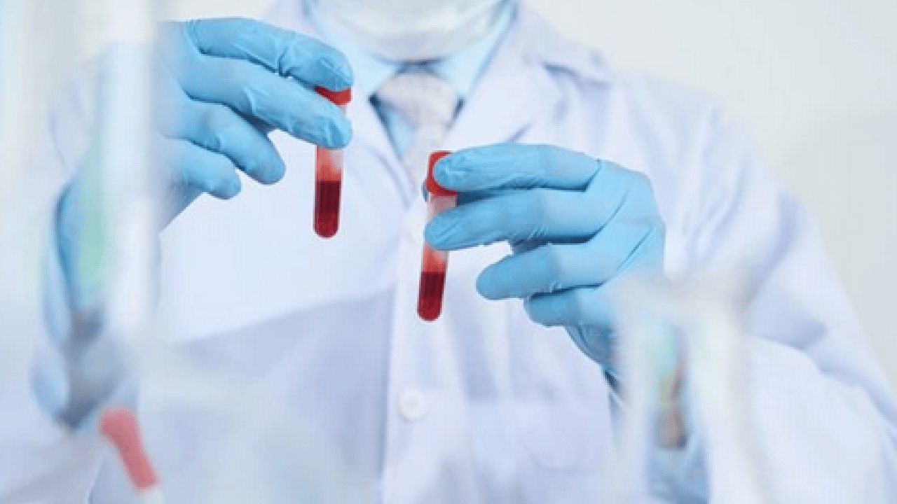 Foto - Tümöre ait DNA parçaları... Likit biyopsi kanser takibinde tedavi sürecinin izlenmesine katkı sağlıyor