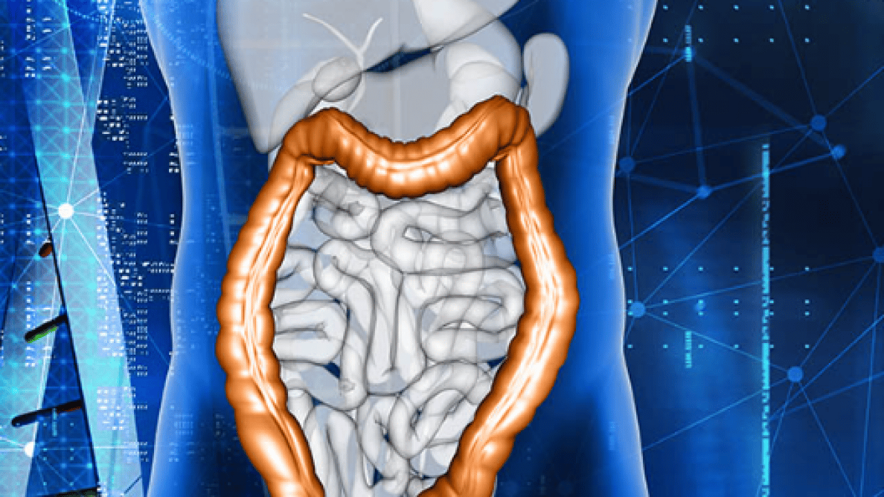 Türk bilim insanlarından çığır açan gelişme! Kolon kanserinde umut ışığı