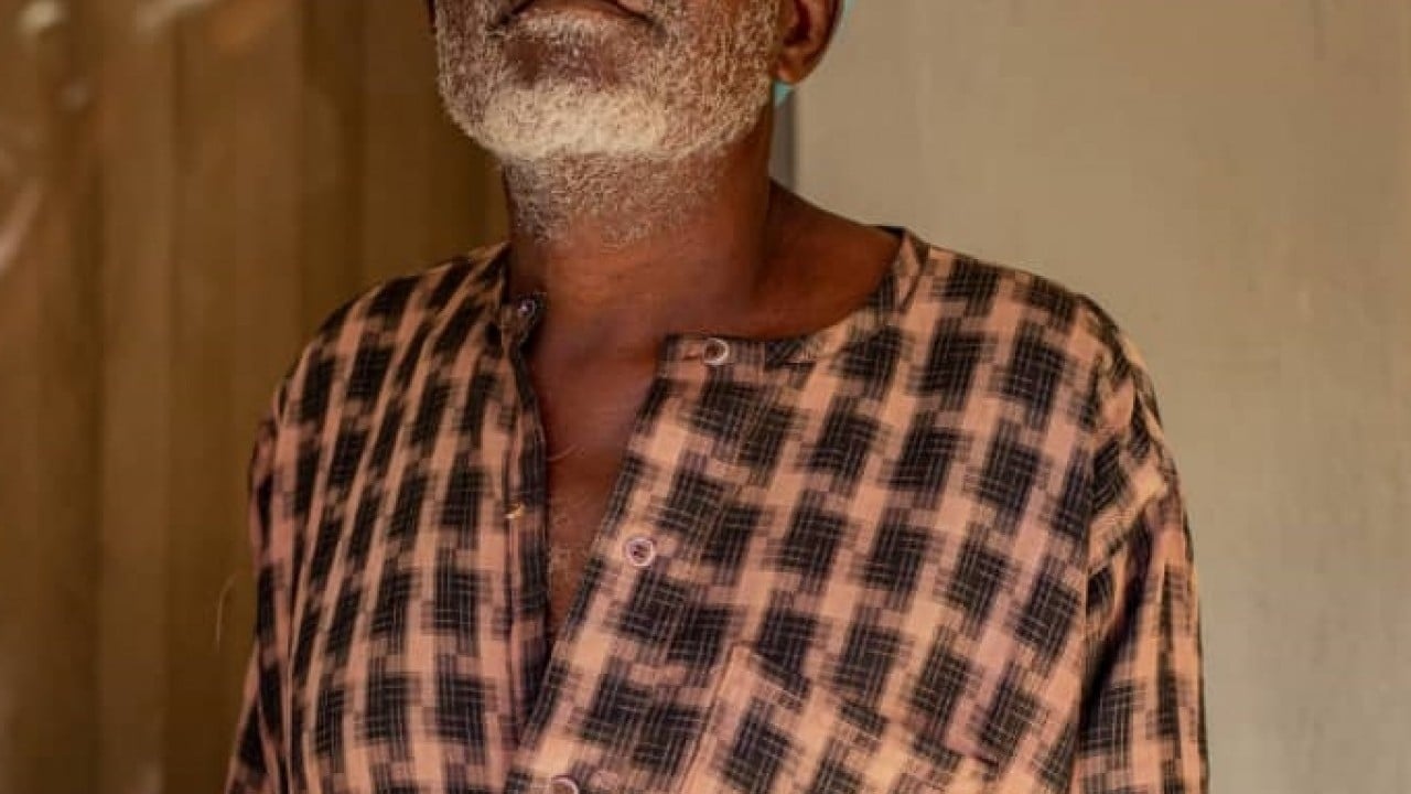 Foto - Türkiye Diyanet Vakfı, Nijerya'da yüzlerce kişinin katarakt ameliyatını yaptırdı