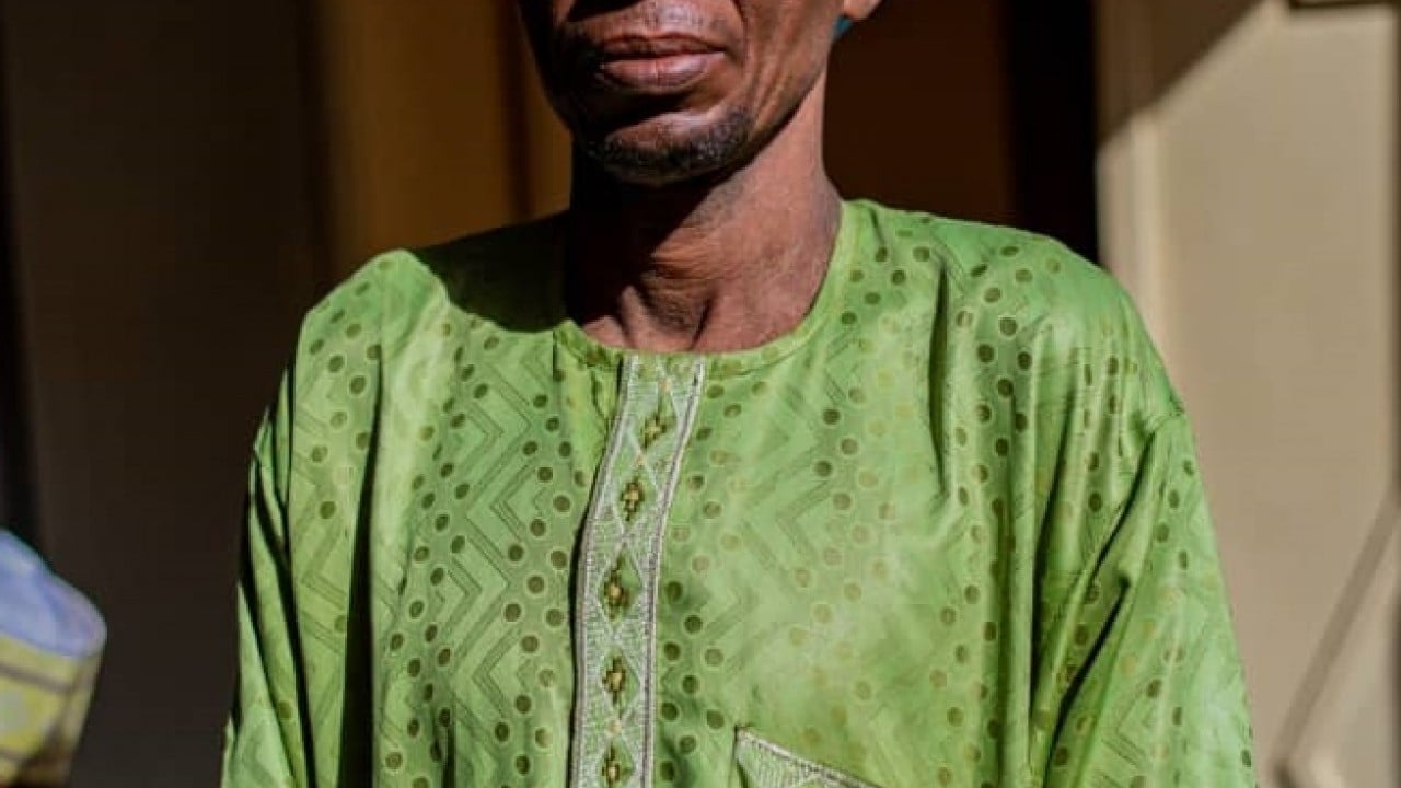 Foto - Türkiye Diyanet Vakfı, Nijerya'da yüzlerce kişinin katarakt ameliyatını yaptırdı