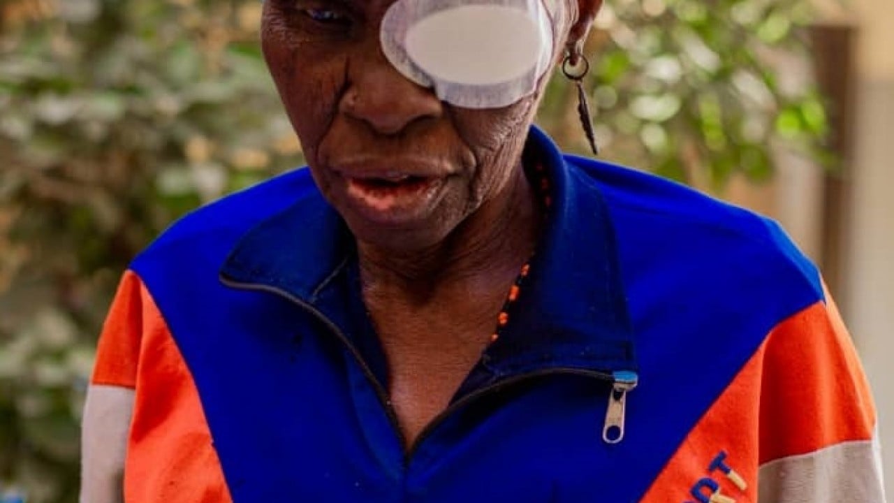 Foto - Türkiye Diyanet Vakfı, Nijerya'da yüzlerce kişinin katarakt ameliyatını yaptırdı